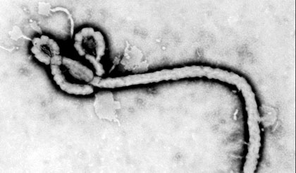 Virus Ebola vô cùng đặc biệt, nguy hiểm và lây lan rất nhanh. Ảnh: KT