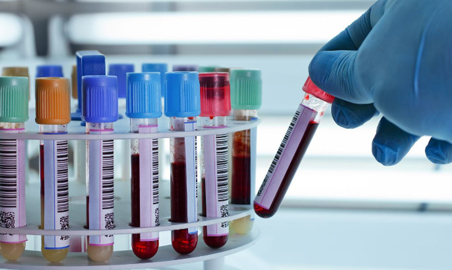 Giá trị thường nằm trong khoảng từ 4.300 đến 10.800 tế bào/mm3.