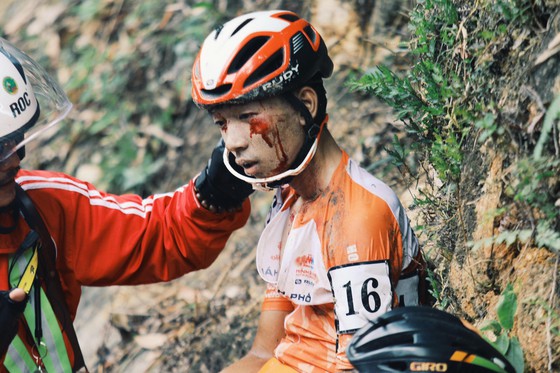 Tay đua trẻ Ngọc Long không may bị gãy 2 cổ tay. 