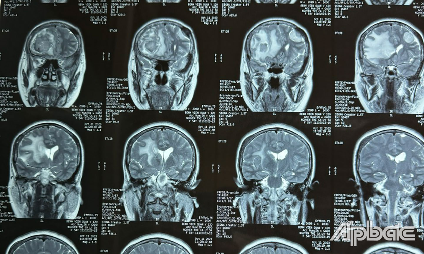 Hình ảnh chụp MRI bệnh nhân.
