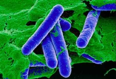 Bộ Y tế cảnh báo độc tố 'hủy hoại thần kinh' trong đồ ủ chua, đóng hộp