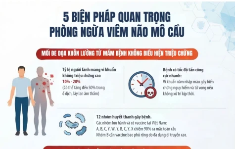 [Infographic] Khuyến cáo 5 biện pháp trọng tâm phòng ngừa viêm não mô cầu