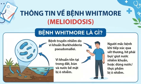 [Infographic] Thông tin về bệnh Whitmore (Melioidosis)